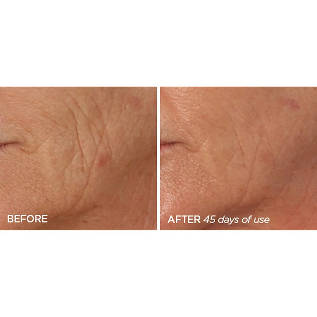 The 4B Treatment Reversal Phase Beauty & 4A Retinol Bioscience R45 Serum 2