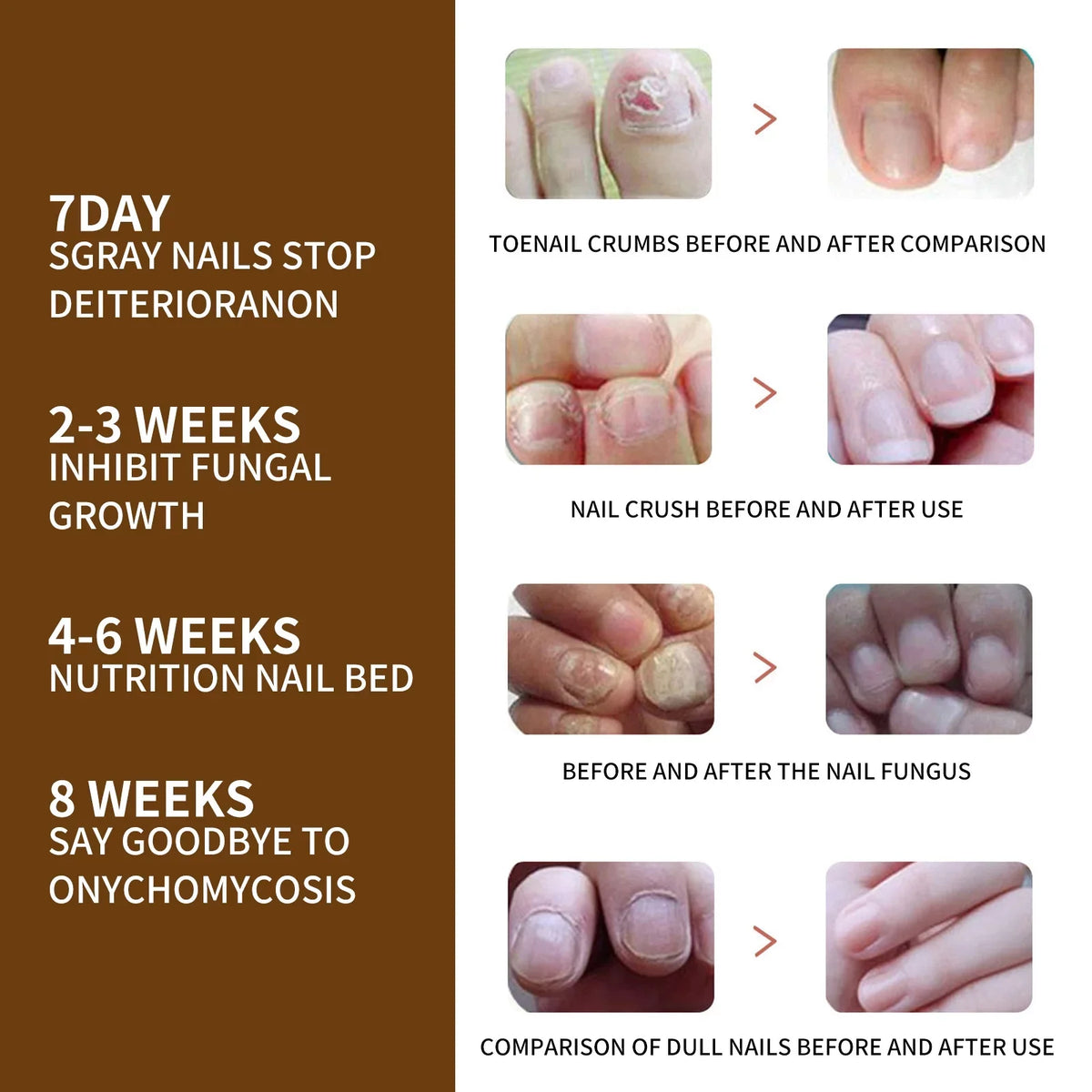 Growth Nail Growth Nails and and Growth Serum, Serum, Nail Reconstrux Nail Growth Repair Serum, Damaged Strengthening Nail Nail for Serum Organic Healing Nail for Growth, 3PCS Deep