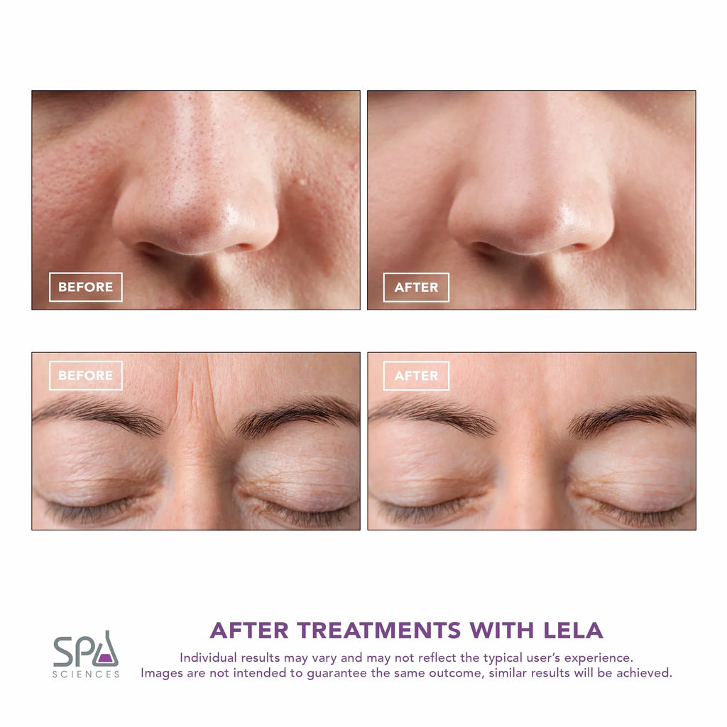 Spatula, Skin Spa LELA Sciences Mint